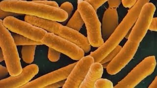 E. coli outbreak linked to carrots kills 1, hospitalizes 15