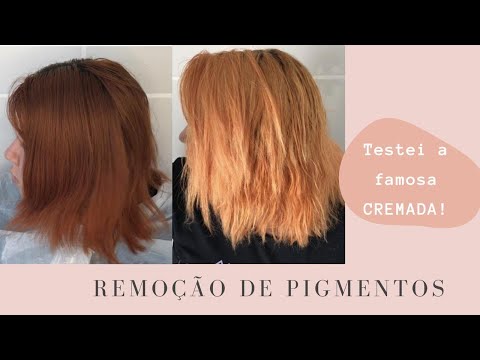 Pigment removal with cream - CREMADA