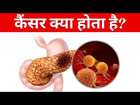 Cancer kya hota hai aur kaise hota hai | What is cancer in hindi?