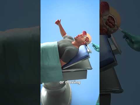 Why brain 🧠surgery are done while awake🥱🥱😱😱#brain#viralvideo#shorts#viralshorts#fyp#funny#thefunspot