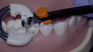 How to Use the Bioclear Adjustable Push-Pull Instrument