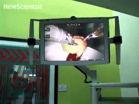 Doctor uses surgical robot to skin a grape
