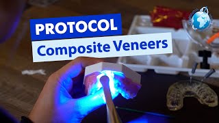 Composite Veneers — Injection moulding technique with Dr. Andrew Elnazir