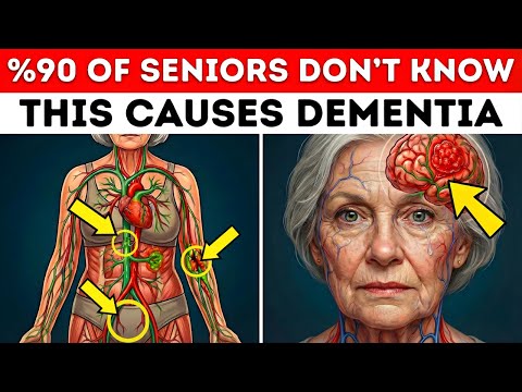 SENIORS: 8 Brain Blood Flow Problems Causing Dementia (Most Miss #4)