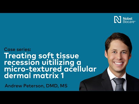 Treating soft tissue recession utilizing a micro-textured acellular dermal matrix 1 - Dr. Peterson