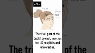 World's First: Boy's Life Transformed by Groundbreaking Epilepsy Implant | TV Intellect