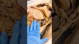 Let's Look Behind a Real Human Liver
