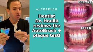 Does It Work? 👀 Dentist Does The AutoBrush Plaque Test
