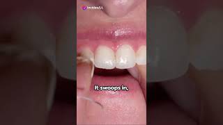 "60 Seconds to Sparkling Teeth!"
