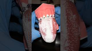 Dentist Reveals TOP 3 Reasons You Have BAD Breath! 🤢🦷