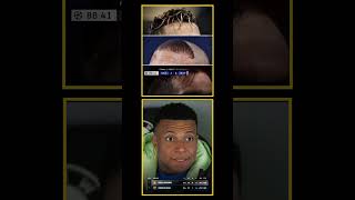 The 8-2 Defeat, Shocking Haircut, and Mbappé’s Facial Expression