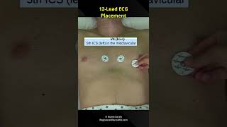 12-Lead ECG / EKG Electrode Placement for Nursing School Students & Nurses #shorts