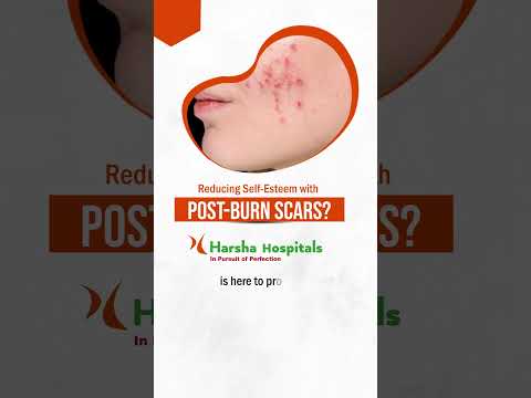 Best Cosmetic Surgeon in Kompally Hyderabad | Harsha Hospital | #harshahospita
