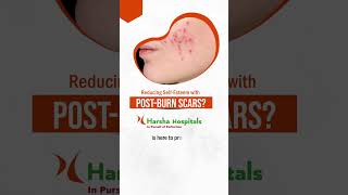 Best Cosmetic Surgeon in Kompally Hyderabad | Harsha Hospital | #harshahospita