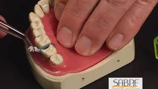 The Bioclear Method - Sabre Wedge