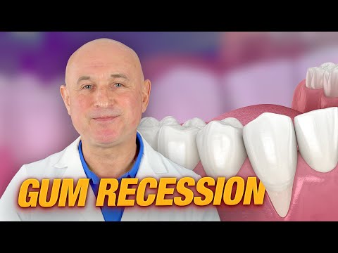 Gum Recession
