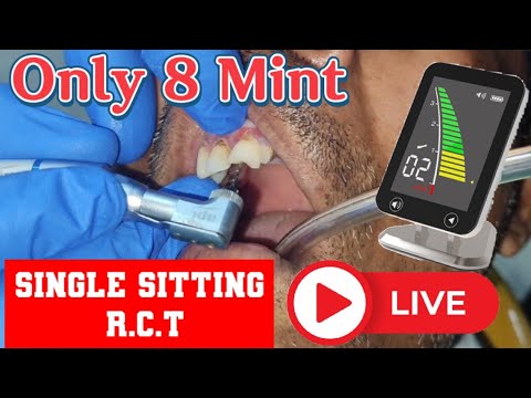 R. C. T Root Canal Treatment //दांतों की नसों का इलाज #rct #video #pawardentalhospital