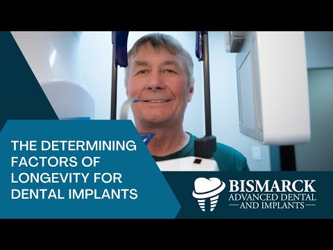 The Determining Factors of Longevity For Dental Implants