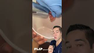 ⛔️WARNING: Stop Using Q-Tips Before It’s Too Late! Real Ear Cleaning by a Pro