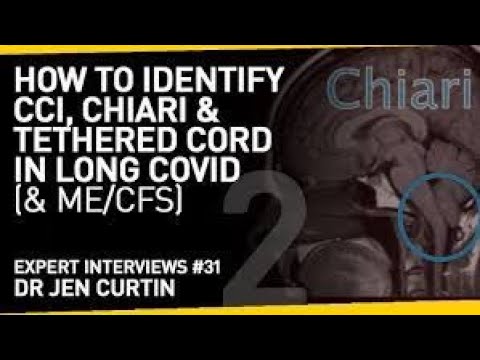 Do you have CCI, Chiari or Tethered Cord? The Symptoms to Look Out For with Long Covid or ME/CFS