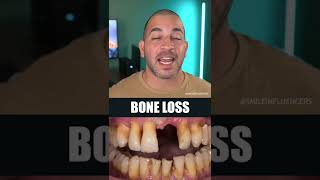 Teeth Cleaning vs Deep Cleaning (VC- Smile influencers)