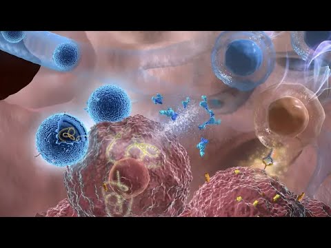 Inhalable Therapy: A Leap in Lung Cancer Treatment #InhalableTherapy #lungcancertreatment