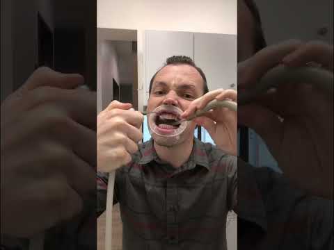 Trying dental cheek retractor!  #dental #donottrythisathome #messy #fortworth #cheeks