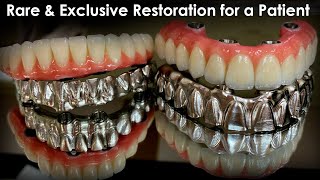 Highly Sophisticated 7-Star Direct Restoration for a Lucky Patient