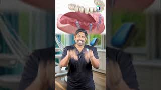 பல்லை நாமே எடுப்பதா அதுவாக விழட்டுமா? - Extraction or Exfoliate? | Dr. Karthikeyan | Denta Kings