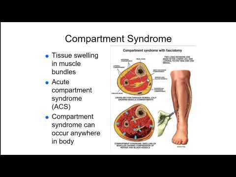 Trauma Presentation