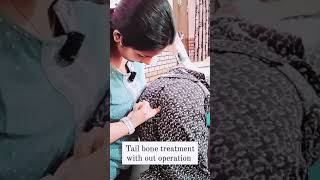 tail bone treatment without operation #fyp #shortviral