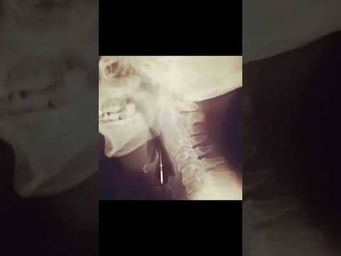 senin orda ne işin var 😱😱 #dental #dentist #diş #dent #turkey #dhf #istanbul #beauty #music #dentist