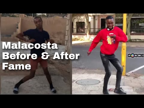 Malacosta before and after Fame | Life Changed ishuuu