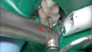 How It’s Made Digital Dentistry