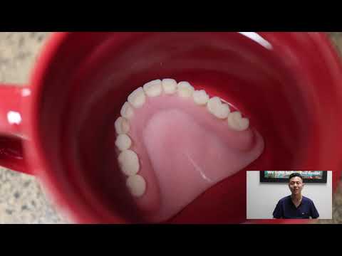How To Take Care of your Dentures! / Cleaning Denture / What to Expect with Your New Dentures