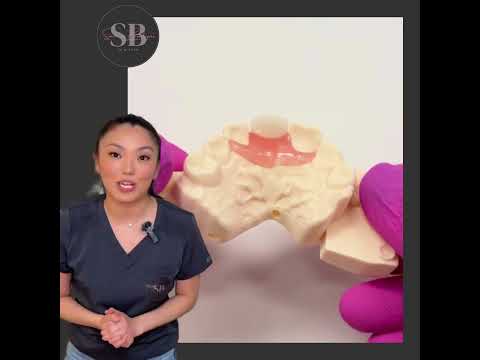 Semi-Flex Flippers: Your Path to a Confident Smile! Everything You Need to Know!