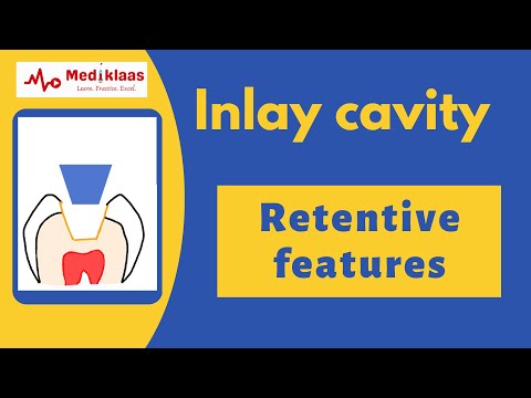 Inlay cavity l Retentive features l Operative dentistry l Mediklaas