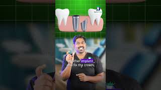 தூங்கும் பல் பதியமா? - Sleeping dental implants | Dr.karthikeyan | Denta Kings