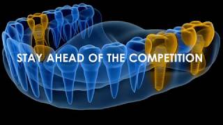 Decoding Digital Dentistry Promo
