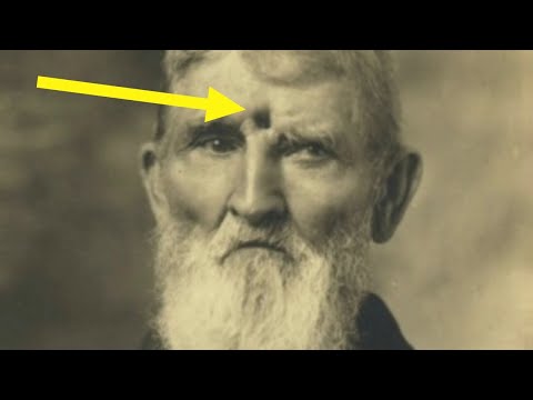 He SURVIVED a bullet between the eyes!