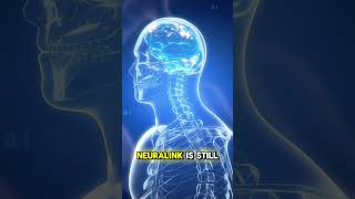 How Neuralink Works - Brain Tech Explained