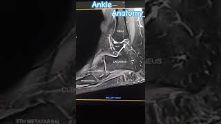 #techlearner #mri #anatomy #paramedical