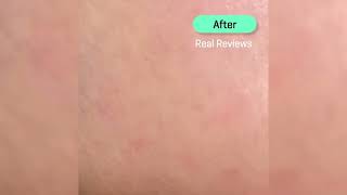 Some By Mi AHA BHA PHA 30 Days Miracle Toner – The Ultimate Anti-Acne Solution for Clear Skin