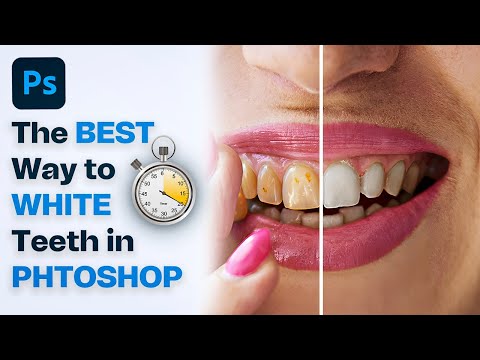 The BEST Way to Whiten Teeth in Photoshop | How to Whiten Teeth in Photoshop 2024 (Easy Tutorial)
