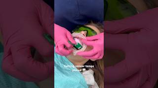 VENEER TEMPS | VENEER PREP #dentist #cosmeticdentistry #smiledental #dentalveneers #veneers