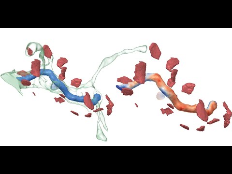 Barrio: Customizable Spatial Neighborhood Analysis and Comparison for Nanoscale Brain Structures