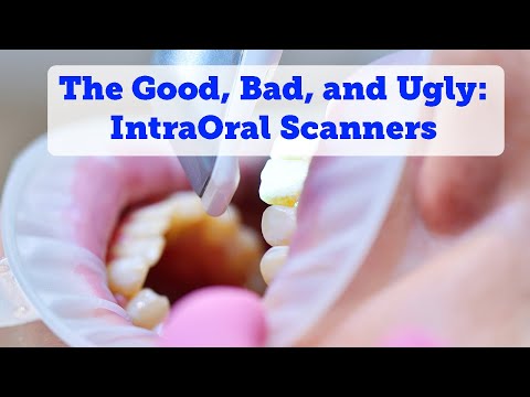 Advancements in Digital Dentistry  - Intra Oral Scanners - Client Reviews & Tips