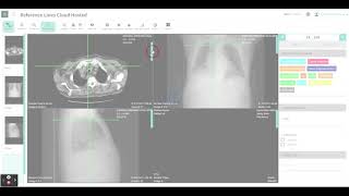TrainingData.io: MultiPlanar View for Radiology