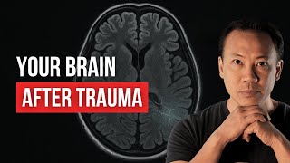 How Trauma Shrinks Your Brain (And How Exercise Reverses It)