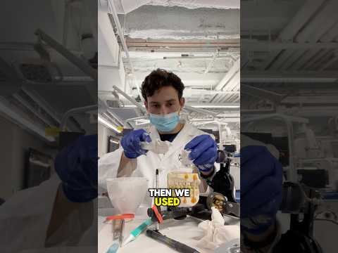 Fixed Prosthodontics 🖌️🦷 #dentist #dentalschoollife #dentalstudent #dental #dentalschool